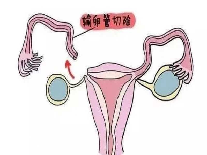 广州供卵试管婴儿助孕机构一览，附供卵医院名单？