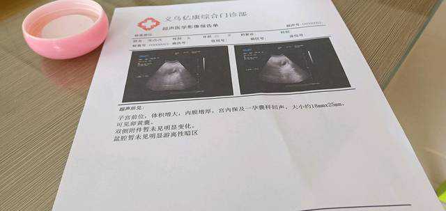 广州助孕哪里便宜，广州试管助孕价格多少_广州做三代试管婴儿多少钱