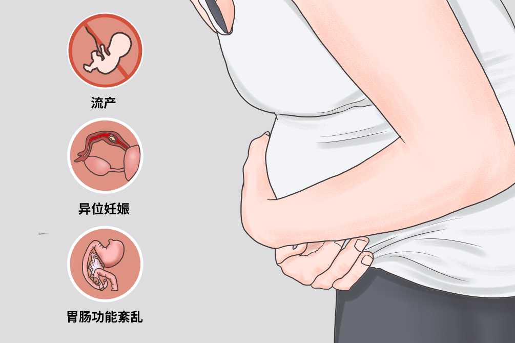 广州正规代怀孕-广州试管代怀的价格