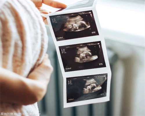 预防胎停育的五大要点