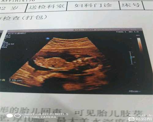广州正规代孕招聘如果你代怀孕了，最好远离这