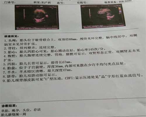 广州代孕价格代孕多久可以检测出来？