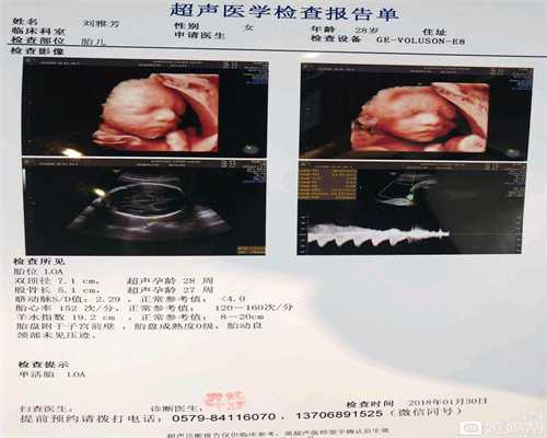 广州正规代怀孕机构40岁做试管婴儿终于好孕，折