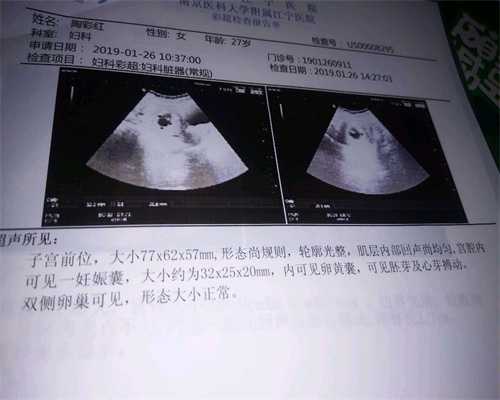 广州代孕哪里技术好：导致输卵管堵塞的原因有