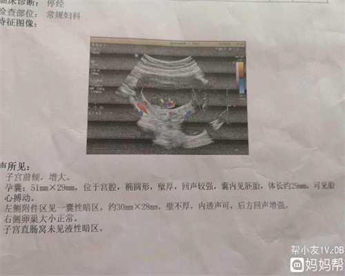 中国代孕成功率：腮腺炎乃“精子杀手”之一