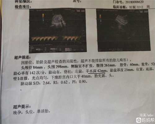 广州三代试管包生男孩：双子宫,治疗方法是什么