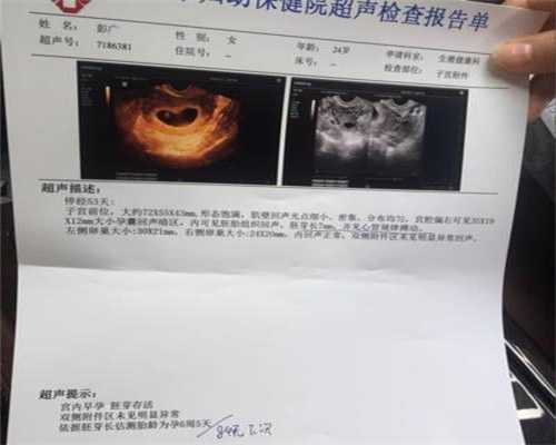 北京代孕流程:巧克力囊肿采用手术治疗会影响生
