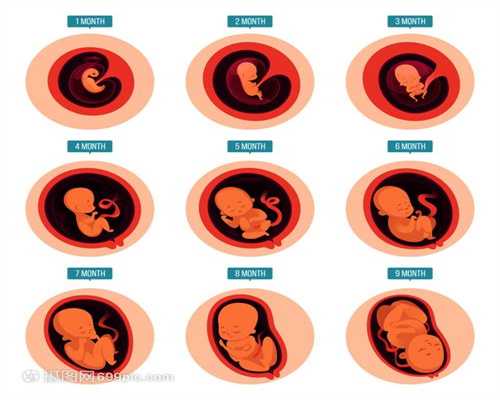 上海代孕中介:在五九医院检查出多囊卵巢综合征