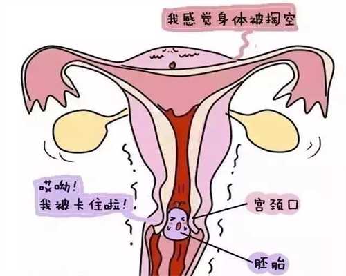 长沙代孕是怎么操作的,月经第三天检查性激素六
