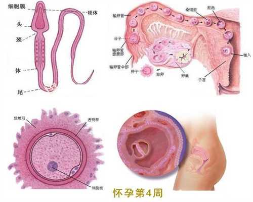 广州代妈联系·广州中国正规规孕机构·输卵管扭