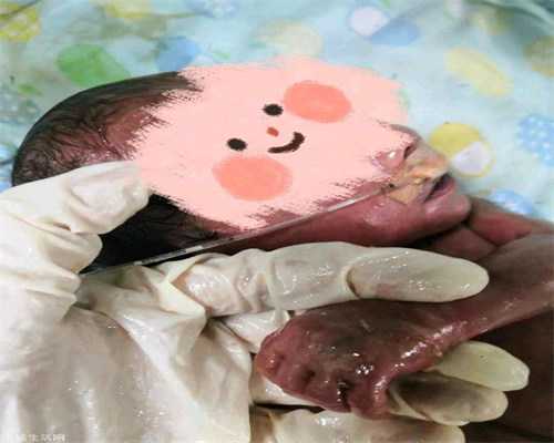 广州孕达国际生殖中心·个人代孕妈妈网站·孕中