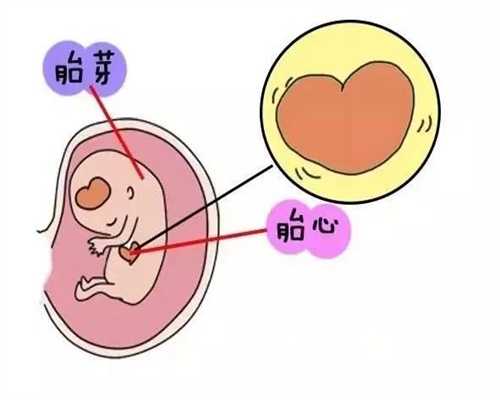 代母产子是什么意思,广州圆梦助孕中心,稀有血型