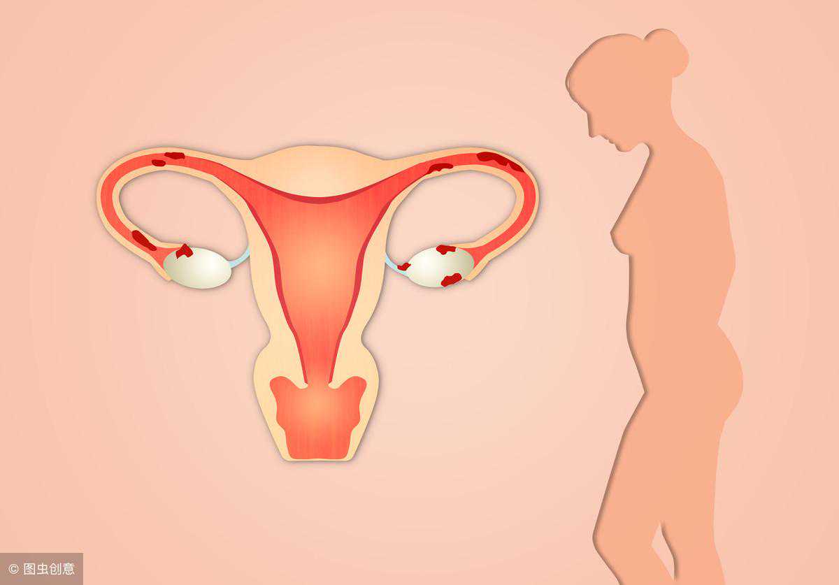 患有子宫肌瘤的女性不可贪嘴，降脂很重要